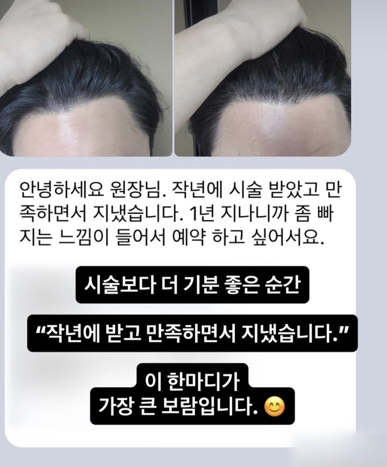 시술 1년 뒤 리터치를 문의한 고객 메시지와 헤어라인 두피문신 전후 사진