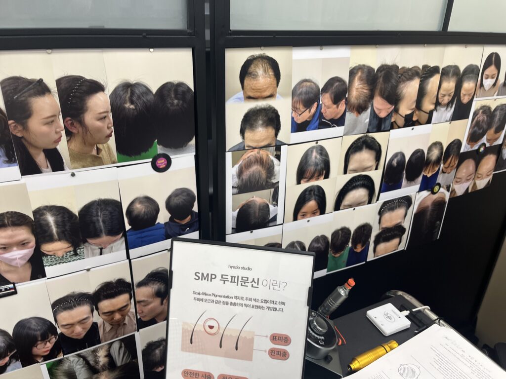 혜지오 상담실에 비치된 두피문신 시술 사례와 안내 자료
