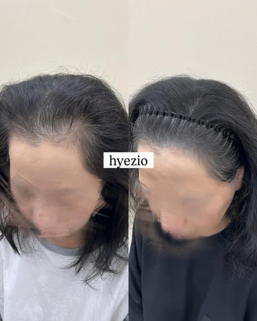 밀도와 여백의 균형을 맞춰 정리한 앞머리 전후 비교