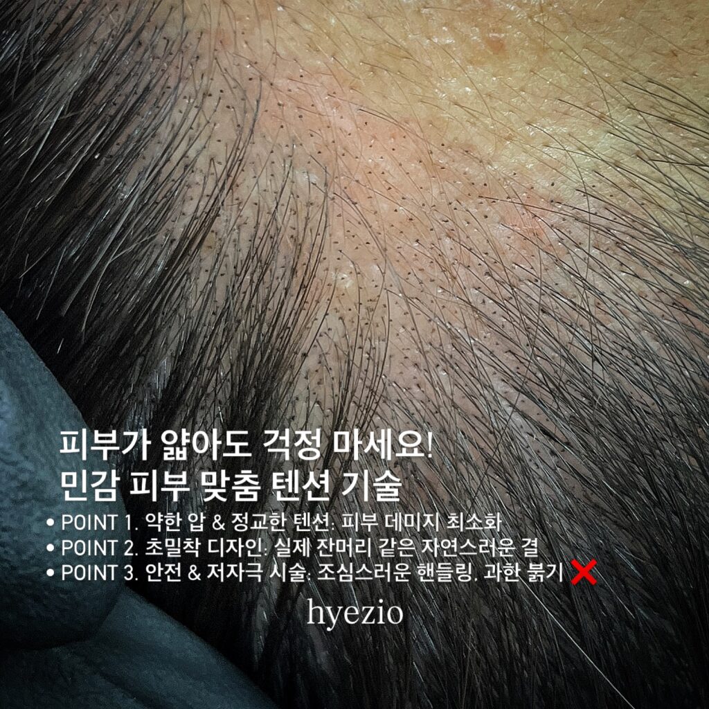 얇은 피부에 맞춰 압과 텐션을 조절한다는 안내 이미지