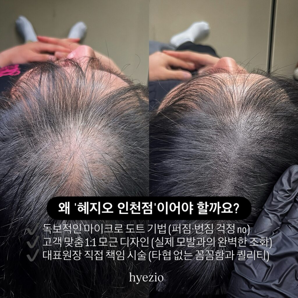 마이크로 도트 기법과 1:1 모근 디자인을 소개한 이미지