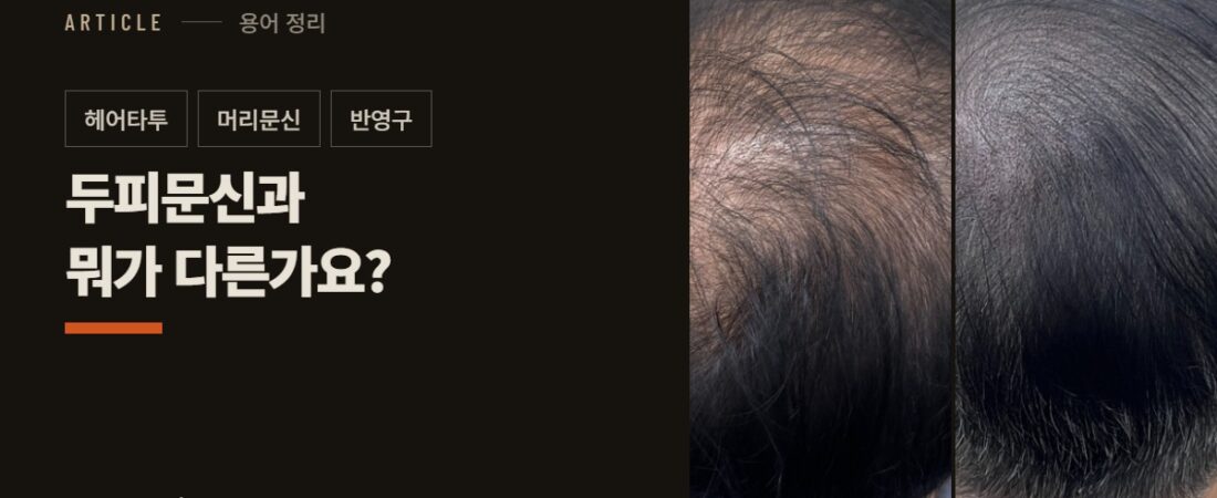 헤어타투, 머리문신, 반영구… 두피문신과 뭐가 다른가요?