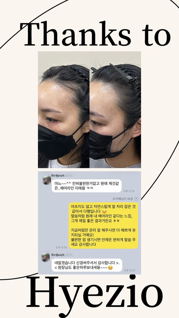 시술이 아프지 않고 자연스러웠다는 고객 카카오톡 후기와 헤어라인 측면 전후 사진