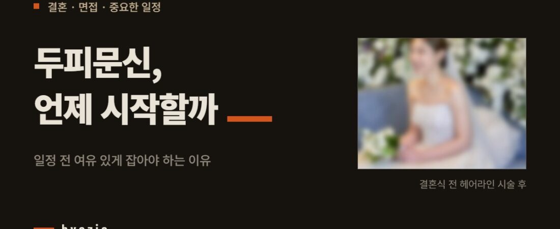 결혼·면접·중요한 일정 앞두고 받는 두피문신, 언제 시작할까