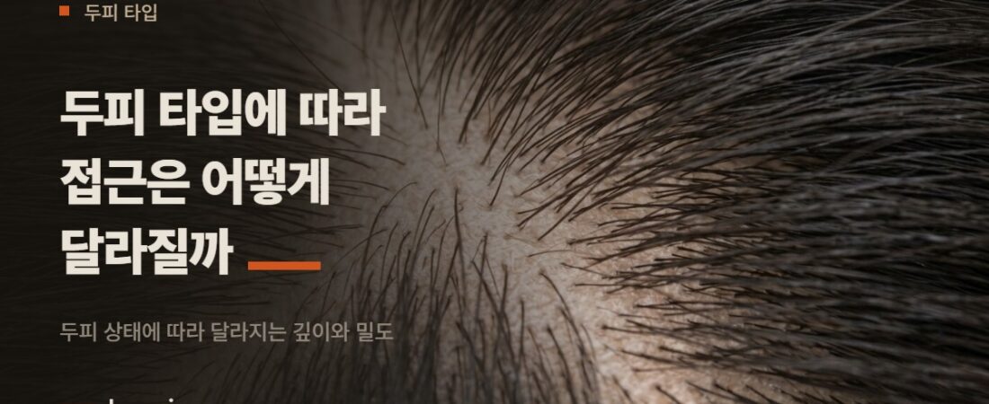 두피 타입에 따라 두피문신 접근은 어떻게 달라질까