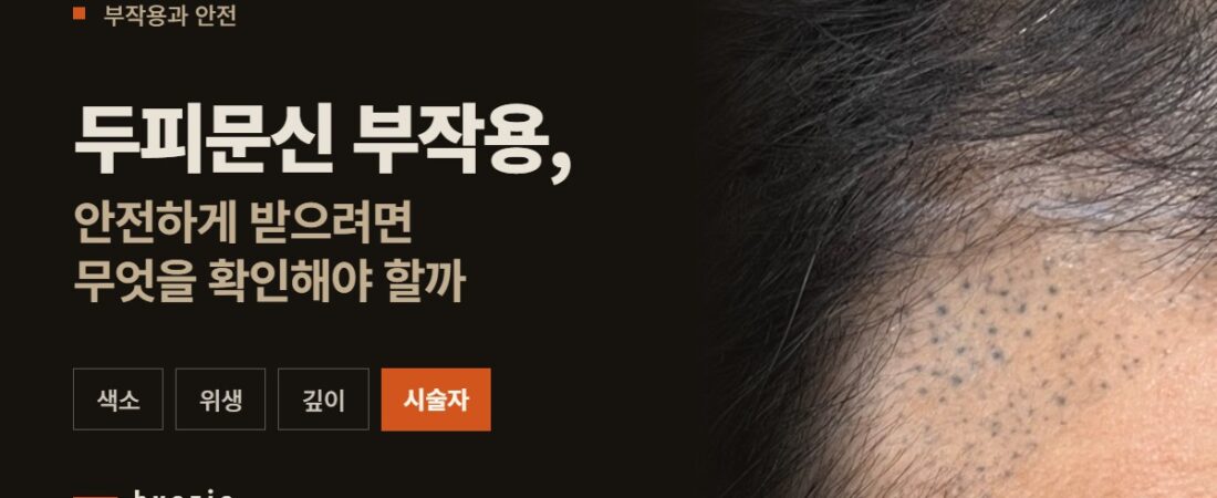 두피문신 부작용, 안전하게 받으려면 무엇을 확인해야 할까