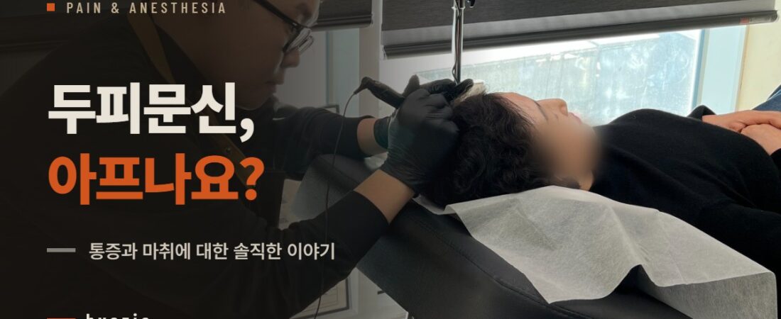 두피문신 아픈가요? 통증과 마취에 대한 솔직한 이야기