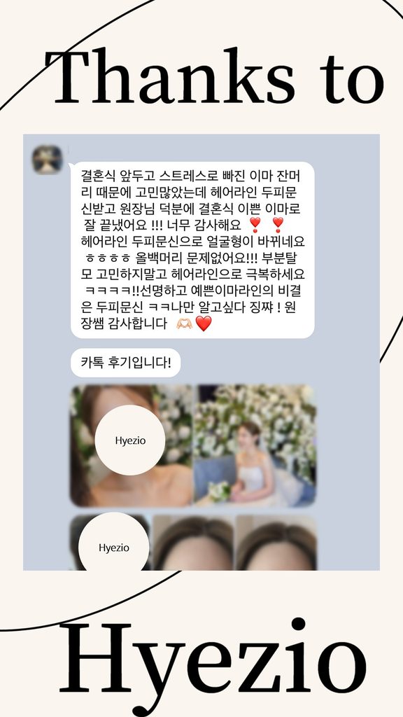 결혼식을 앞두고 헤어라인 두피문신을 받은 고객의 카카오톡 후기 이미지
