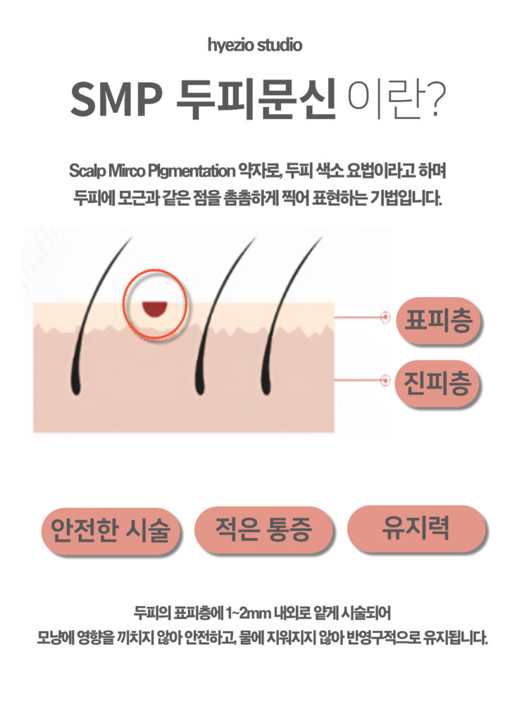 두피문신(SMP)의 원리를 설명한 안내 이미지
