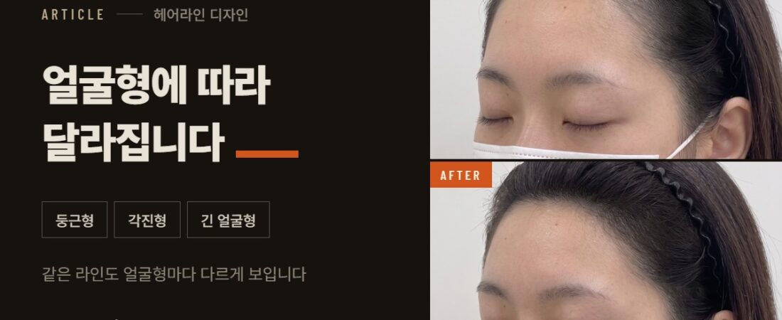 헤어라인 디자인, 얼굴형에 따라 어떻게 달라질까