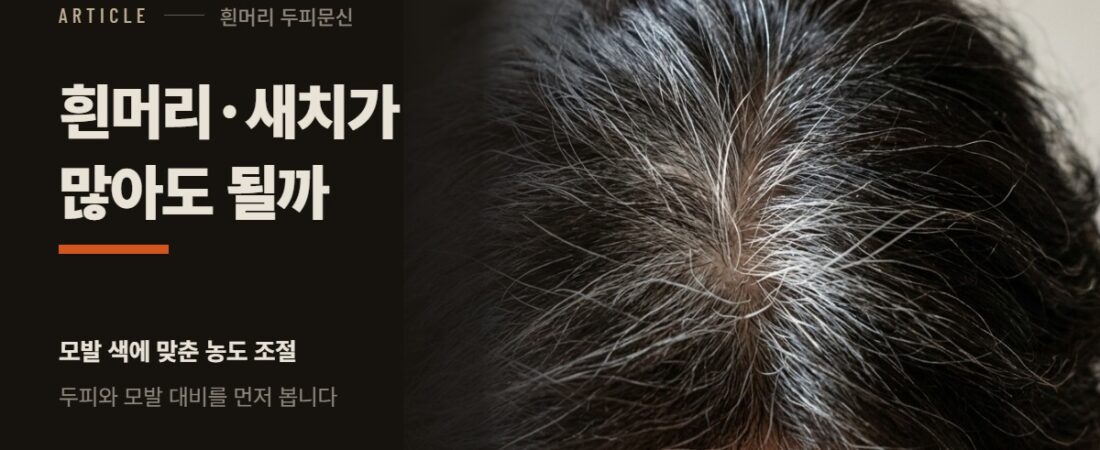 흰머리·새치가 많아도 두피문신이 되나요