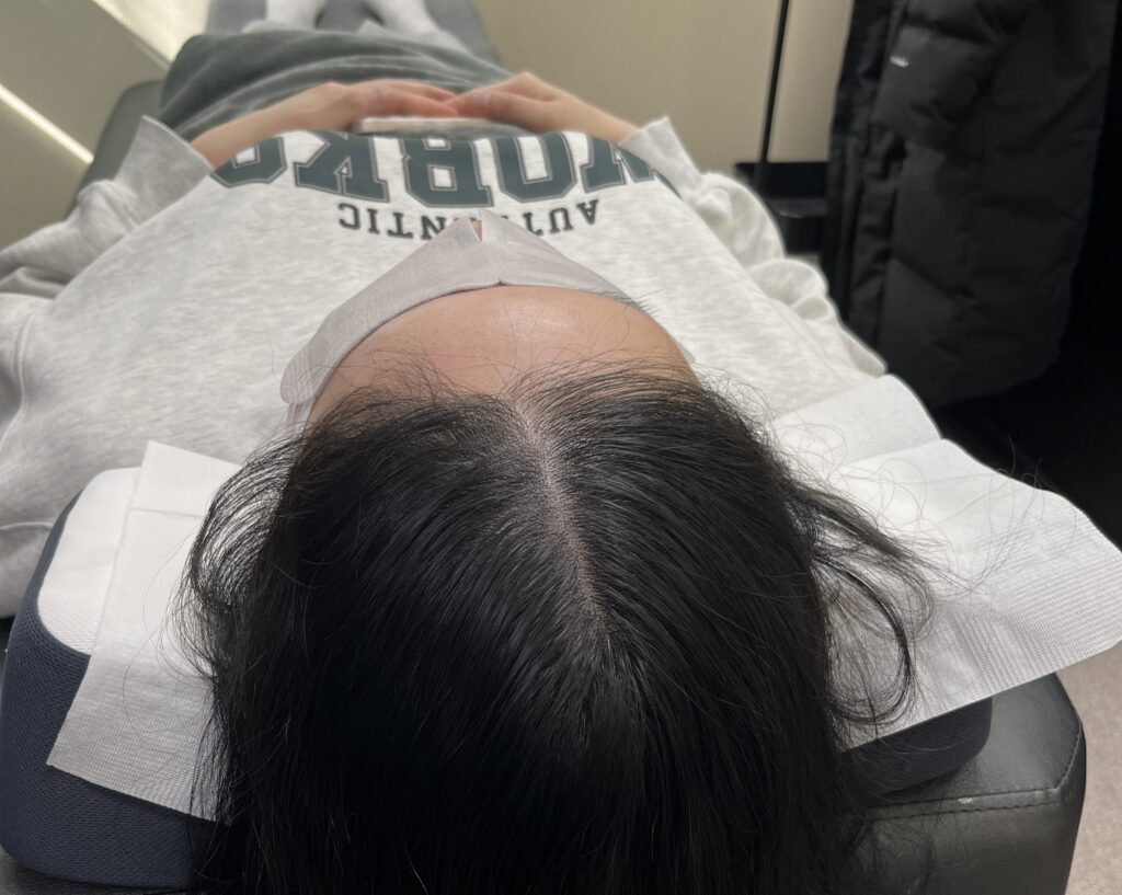 시술대에 누워 다음 회차를 시작하기 전 가르마 상태