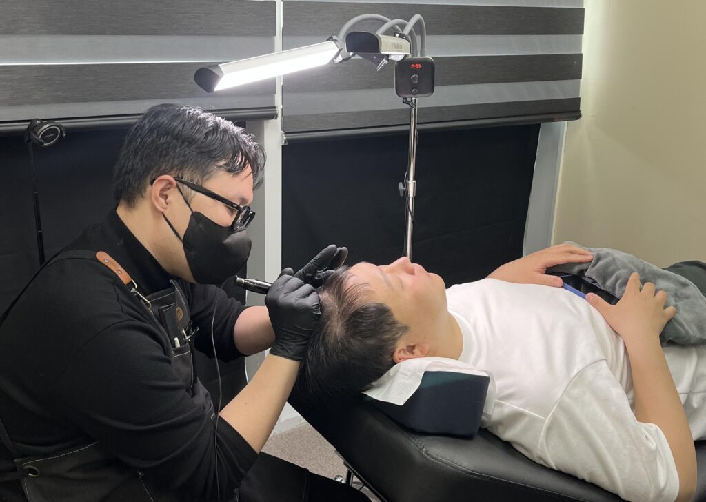 조명 아래에서 남성 M자 헤어라인에 두피문신을 시술하는 모습