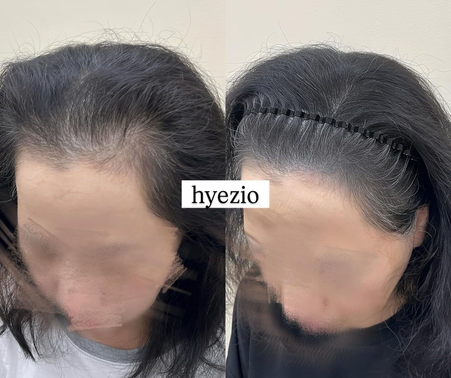 밀도와 여백의 균형을 맞춰 정리한 앞머리 전후 비교