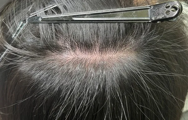 도트 확대 클로즈업